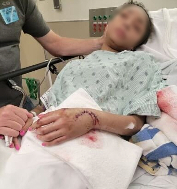 Teenage Girl Bites Shark, Fist Escape'Fight for Family'