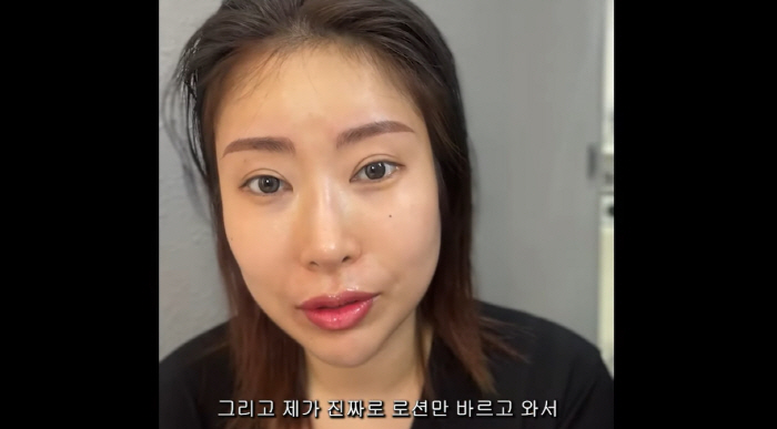 Lee Se-young 'Face plastic surgery..I wanted to have perfect facial features' I'm very satisfied