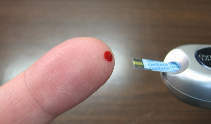 Risk of amputation to small wounds How to manage summer 'Diabetes'