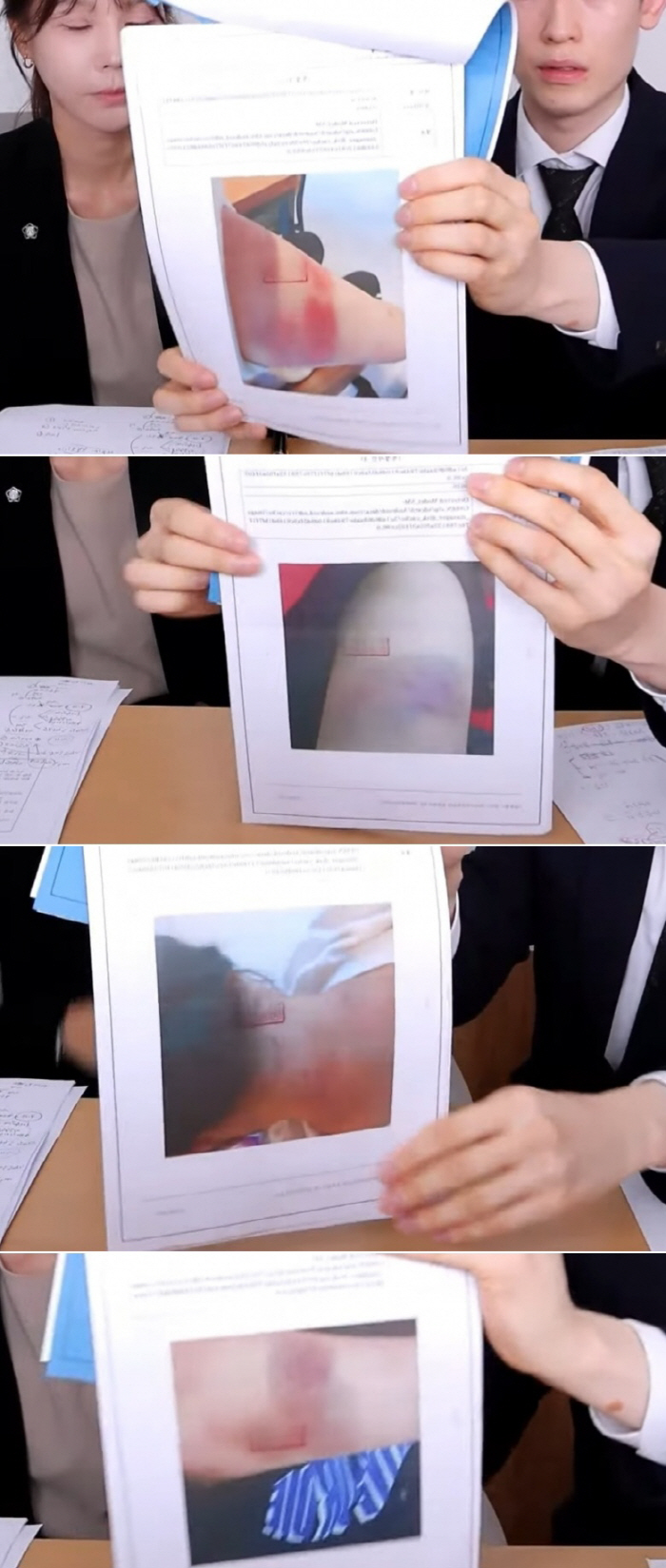  Tzuyang, there was a bruise on her forearm every time'Assault → Forced exploitation of businesses' Ex-boyfriend's viciousness re-examined