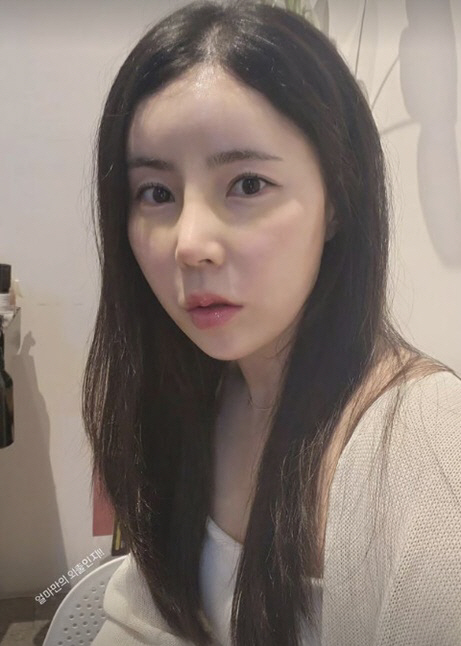 Young-sook, 10th term, nose bridge that has increased significantly after nose plasticization 'Delete the mouth-to-mouth magic'