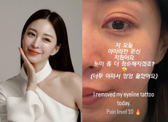 'Pain level 10' Han Ye-seul reveals real-time removal of eyeliner tattoos'It's going to be more innocent, right?'