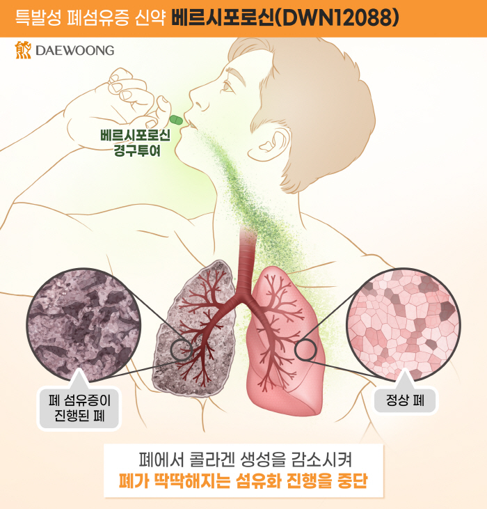 Daewoong Pharmaceutical 'Safety Verification at the 2nd IDMC Meeting'