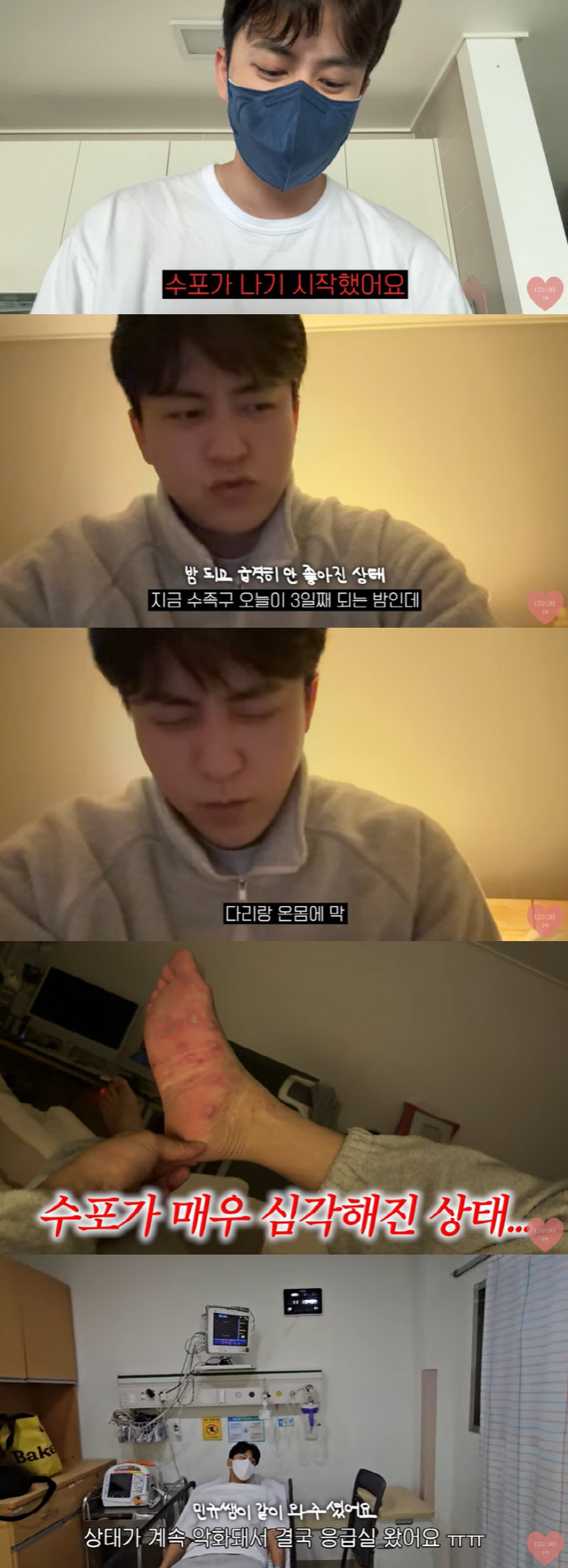 Yoo Hye-joo's husband moved his hand-foot-and-mouth to the 子 and went to the emergency room. 'I can't sleep after falling off my nails and nails.'