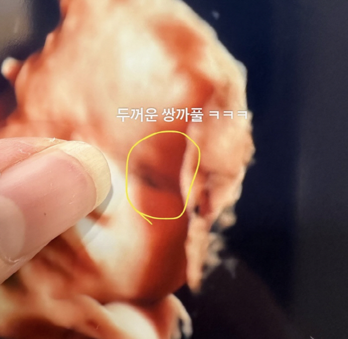 'Park Soo-hong ♥' Kim Daye is happy even if he gains 25kg'Amazed by his daughter's ultrasound photo