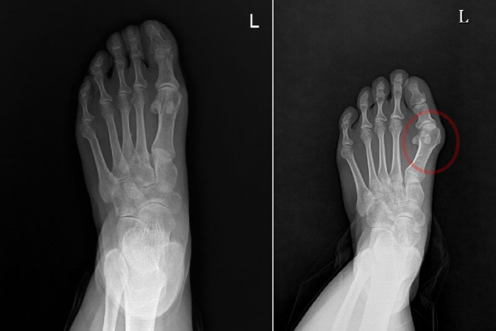 Scared of summer 'Anti-traumatica', causing knee and back pain when left unattended