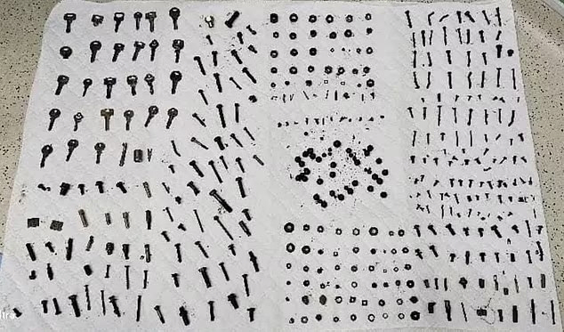 More than 450 screws and nuts found in men's stomach weighed nearly 3kg