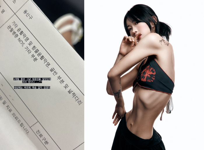 Choi Jun-hee, the late Choi Jin-sil's daughter, is in serious physical condition'Not inflammation, but necrosis' After-loss? Shocking
