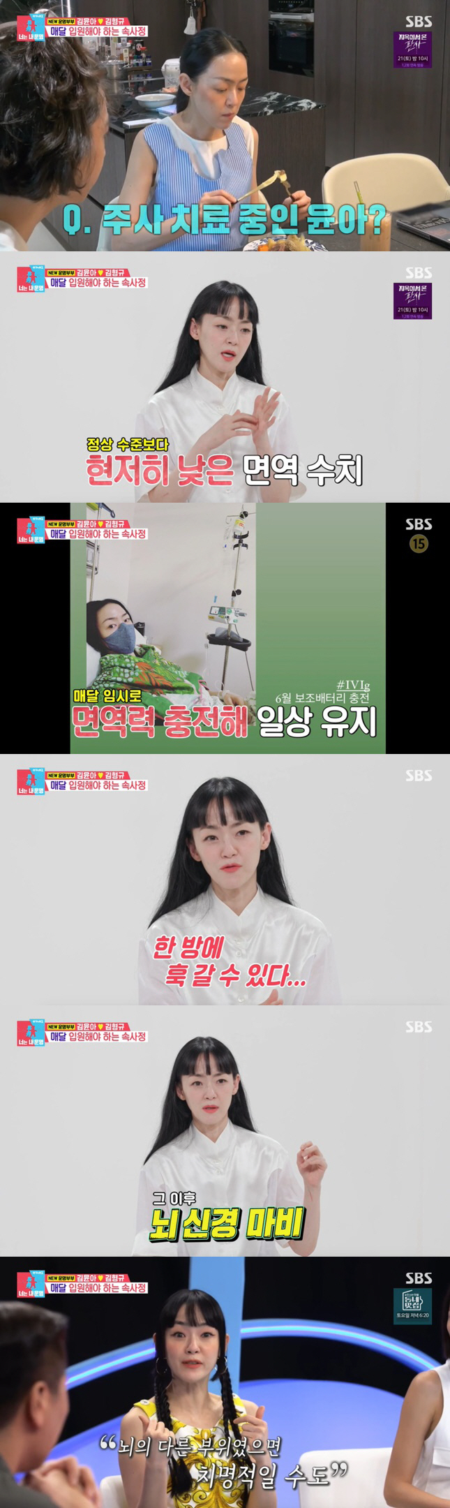 'Brain nerve paralysis'Kim Yuna''Face paralysis, vocal disorder, all at once''Dongsang Imong2'