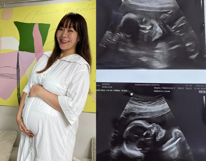 'Mom of Five Brothers' Chung Ju-ri 'It's the fifth time, but it's still amazing' I'm touched by the ultrasound photo.'