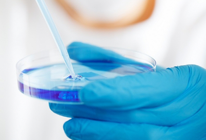 Hundreds of samples of the deadly virus have disappeared, making you nervous? Disposal?