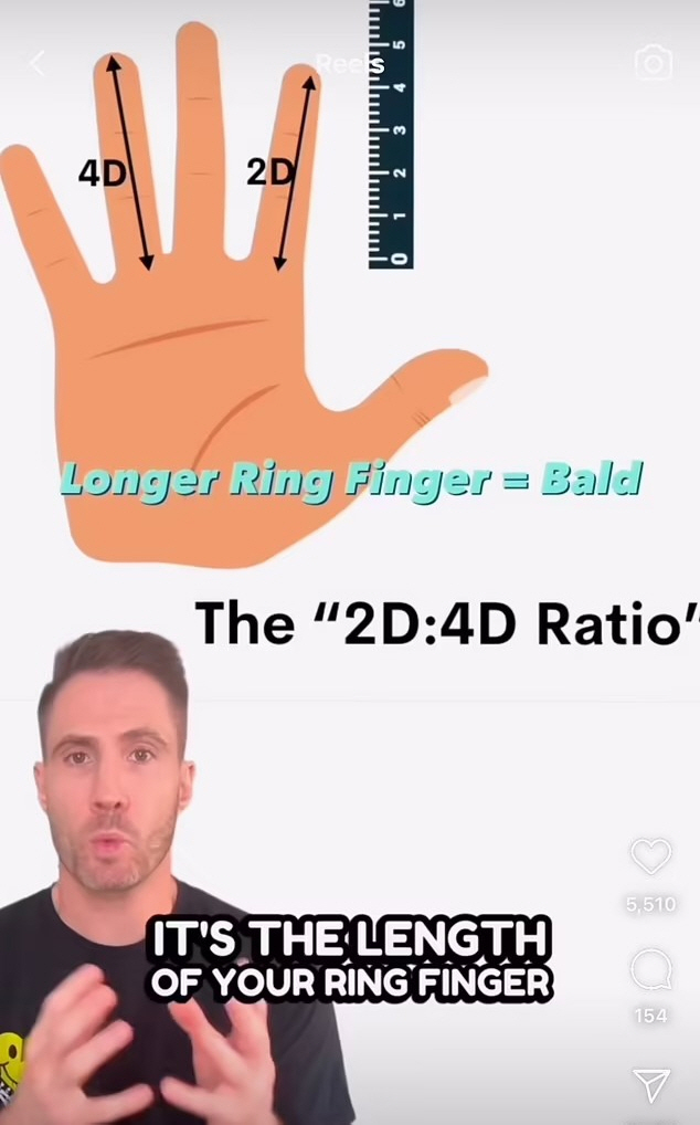 The possibility of baldness. I know when I see my fingers? If the ring finger is longer than the index finger, it's up to 6 times