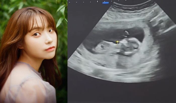  Lee Jin, surprise pregnancy announcement after 6 years of marriage. Baby angel is here