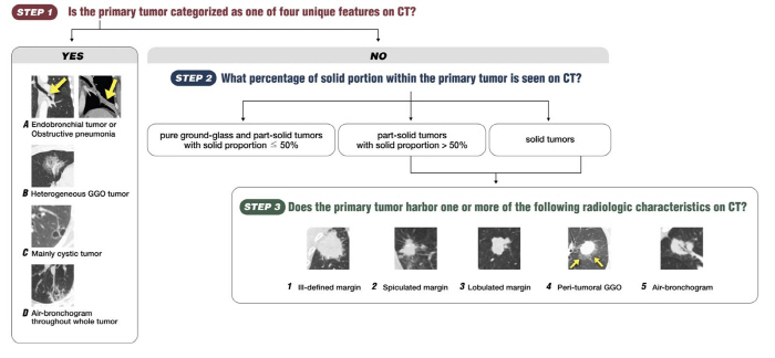 Lung cancer hidden lymphatic metastasis, CT predictable