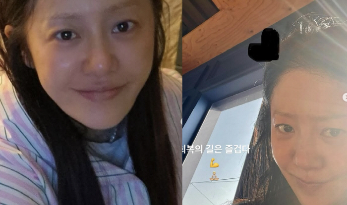 Big Surgery → Discharged Ko Hyun-jung, feeling sorry for her face without blood, the road to recovery is fun. How brave