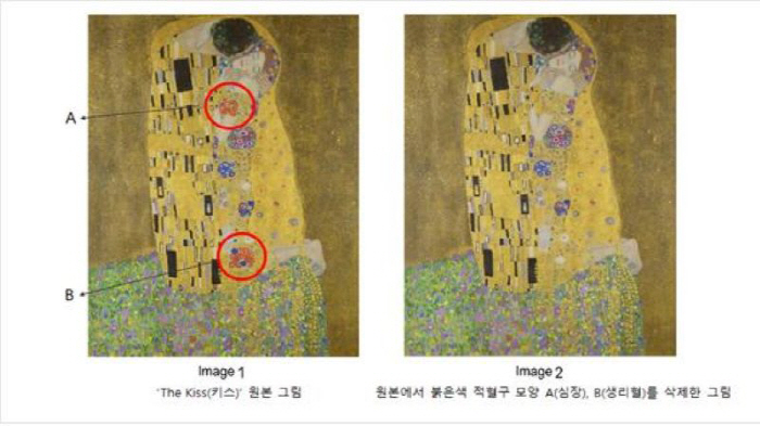 Why did master painter Klimt draw red blood cells on the kiss?