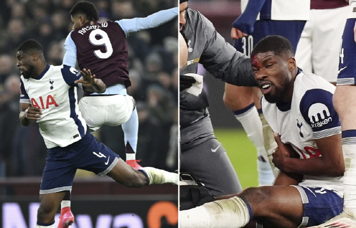 Troublemaker from Manchester United almost ended Tottenham SON's hope on his forehead, but even the remaining pillars are shaken  fans are heartbroken