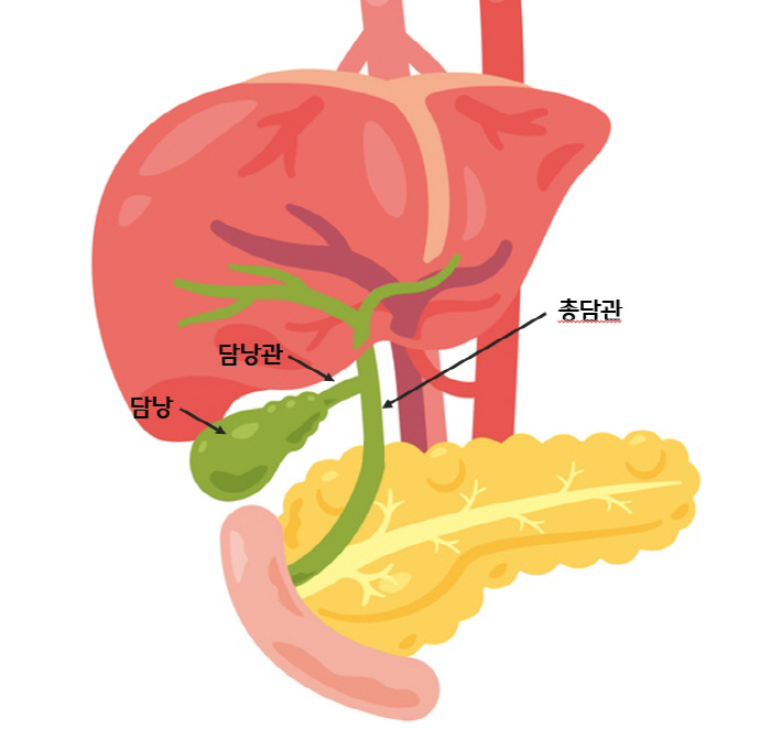 Abdominal pain, fever, suspected bile duct stones when eating greasy food...Too much dieting is also the cause