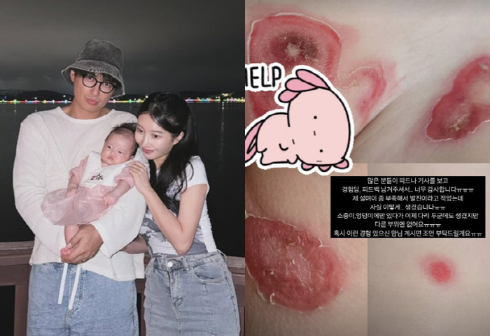 Lee Ji-hoon ♥ Oh, it's my daughter's unknown disease, and she ended up sobbing..the state of one's skin in shock