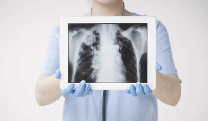 The two faces of the X-ray...What are the safety precautions?
