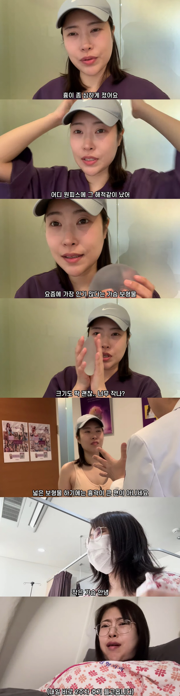 Lee Se-young, who burst into a chest filler, eventually underwent surgery again..A Cup → E Cup Transformation (Yeongpyeong TV) 
