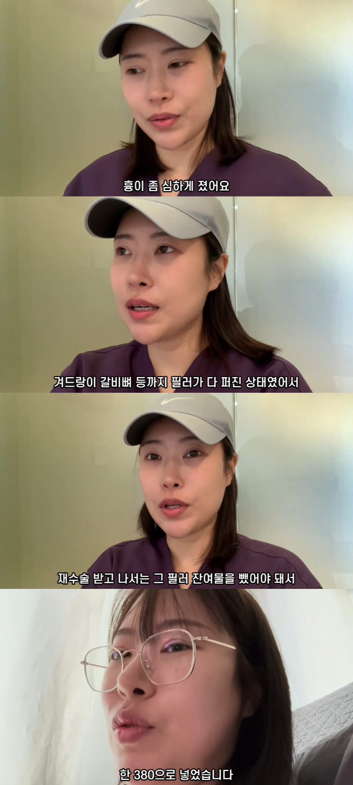 Lee Se-young, who had chest reoperation, scraped all the fillers that burst into E-cup in A-cup (Yeongpyeong TV)