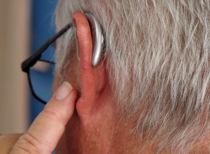 Patients with hearing loss are at 2-5 times higher risk of developing dementia...What about prevention and treatment?