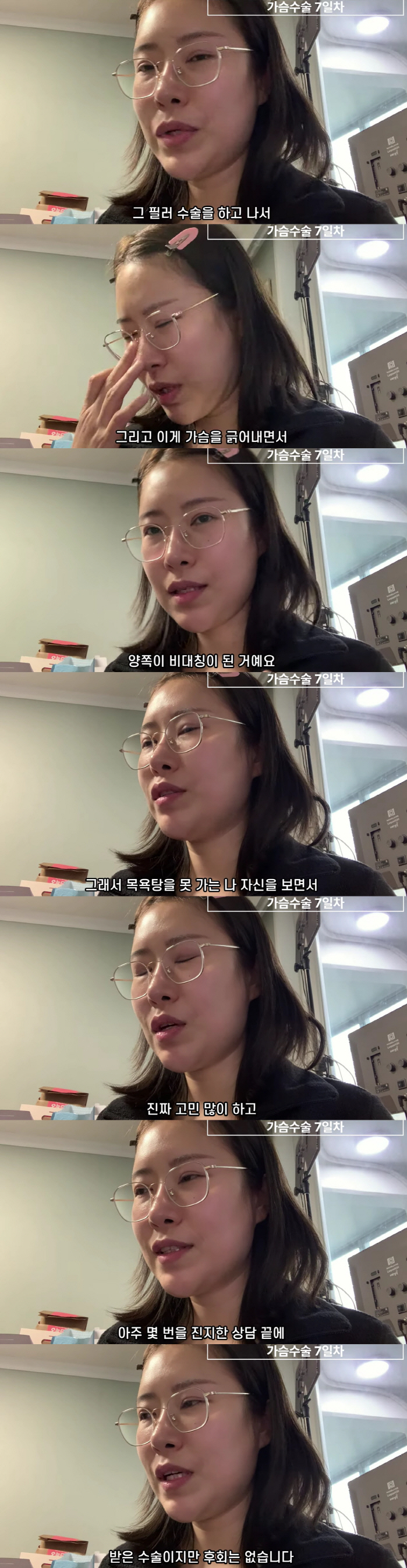 Lee Se-young, who burst into chest fillers, A→E cup after re-plastication is so pretty, I have no regrets (Yeongpyeong TV) 