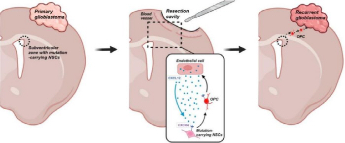 Determining the Cause of Recurrence of Malignant Brain Tumor Glioblastoma...Reveal the neural stem cell mechanism