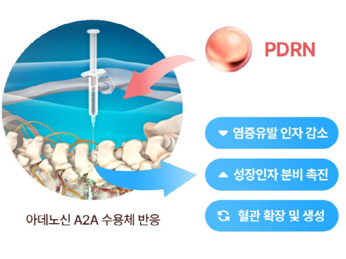 Development of herbal acupuncture using salmon DNA Presents a new treatment mechanism in the regenerative medical field of homegrown oriental medicine hospitals