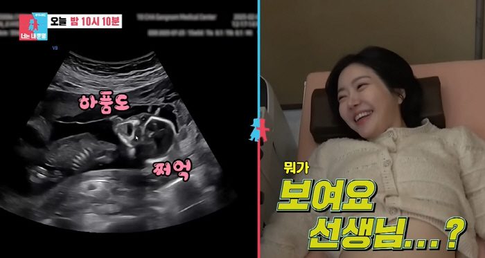 Can you see that? Lady Jane ♥ Lim Hyun-tae reveals the sex of twins for the first time in 15 weeks (Dongsang Imong)