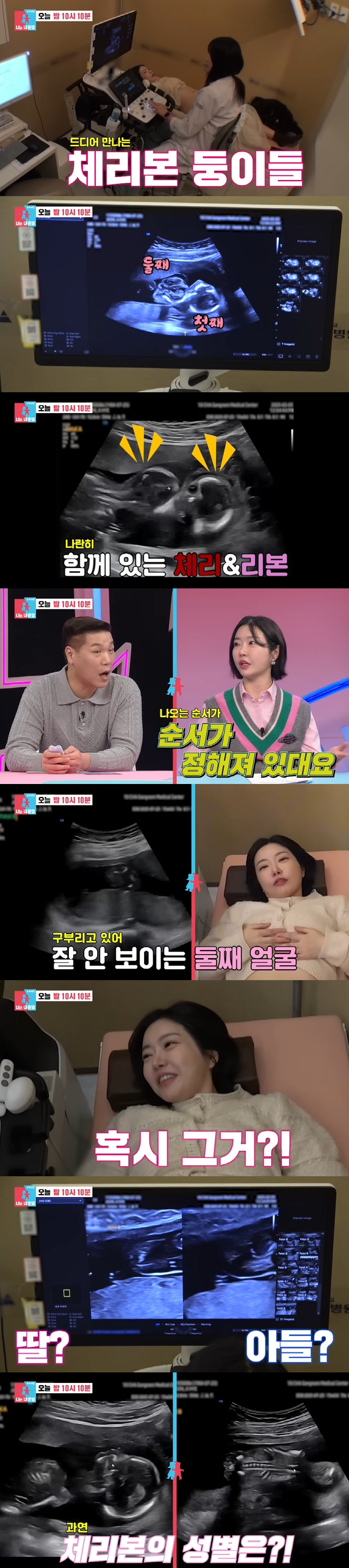 Can you see that? Lady Jane ♥ Lim Hyun-tae reveals the sex of twins for the first time in 15 weeks (Dongsang Imong)