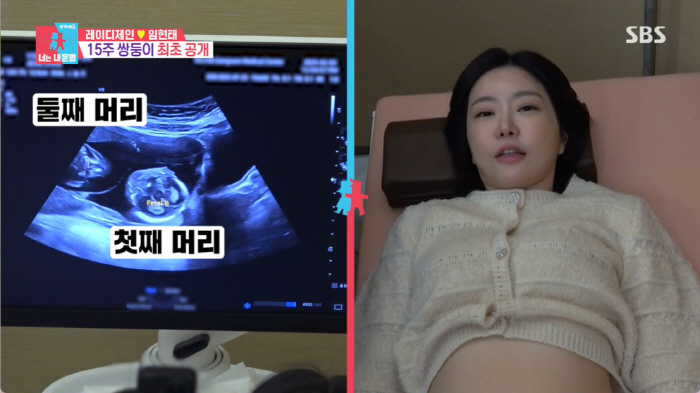 Lady Jane is confused about revealing the sex of twin pregnancy ♥ Lim Hyun-tae, is this a boy? (Same Bed, Different Dreams) 