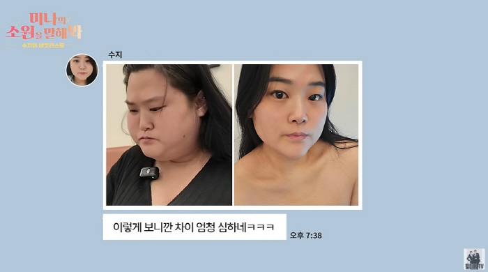 Mina's sister-in-law Suzy lost 60kg  lost forearms  chin fat after the procedure. (Philmi Couple) 