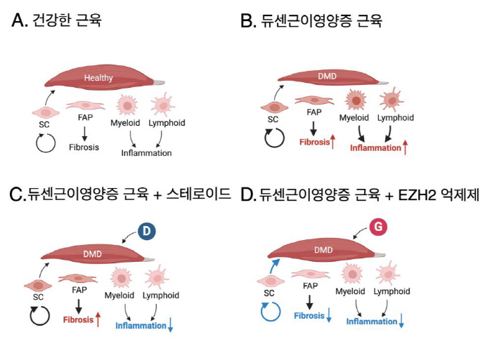 New Treatment Strategy for Rare Disease Dutsenic Muscle Dystrophy...EZH2 inhibitor  steroid effective in combination