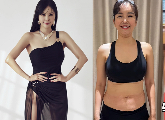 Jang Young-ran, 76kg → 55kg Where did you gain belly fat after losing weight?I gained weight. (Young La New TV)