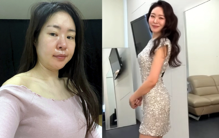 Kim Tae-hyun ♥ Mija, same person?Just 9 days before and after the shock diet