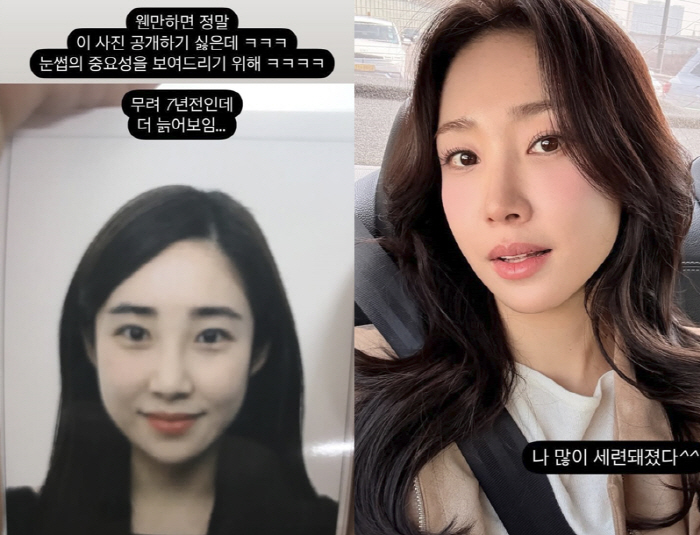 Adul mom Choi Hee looks older and tacky to the point where she misunderstood plastic surgery compared to 7 years ago and now