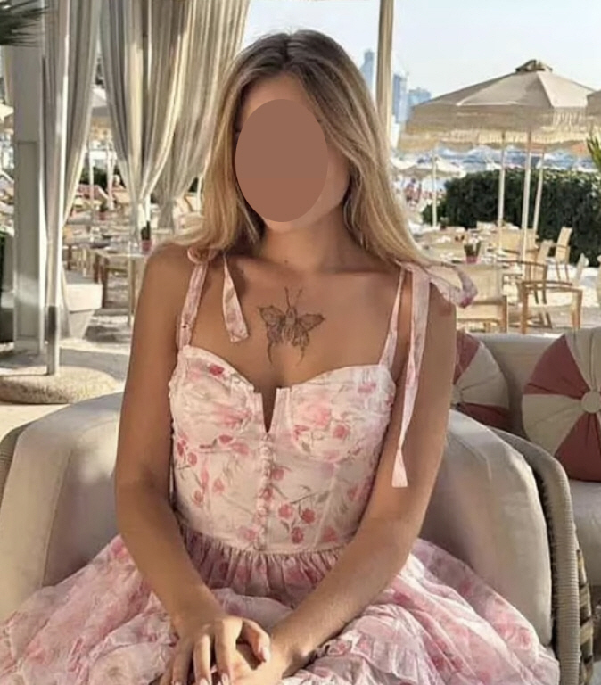 Famous influencer found broken limb 10 days after disappearance...Suspicions of sexual exploitation