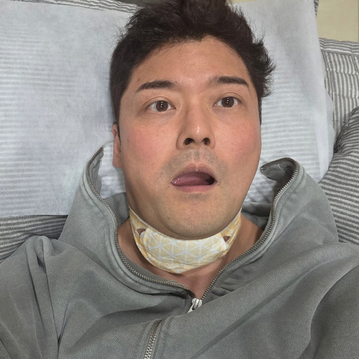 Jeon Hyun-moo, laryngitis. The trend that cannot be missed even by the haggard appearance of the haggard appearance will also end