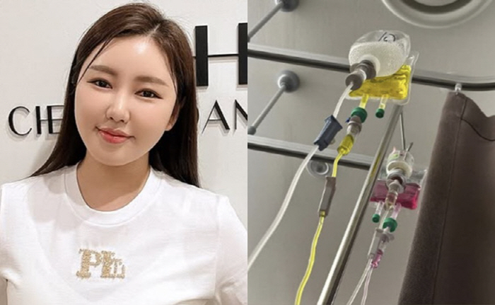 Song Ga-in, 4 IVs due to health problems..a sad state of affairs