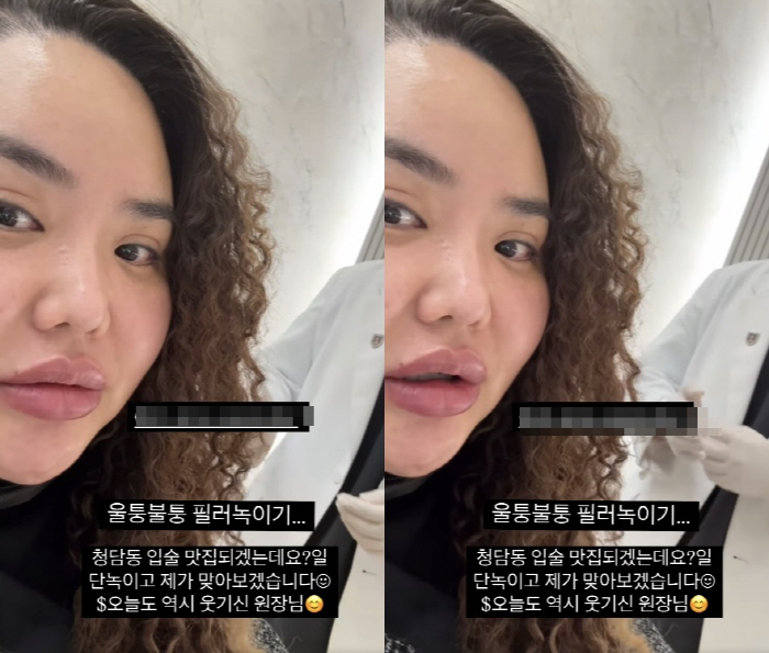 Hong Jin-young, Hong Sun-young, right. She got bumpy..You have to melt it and get hit again