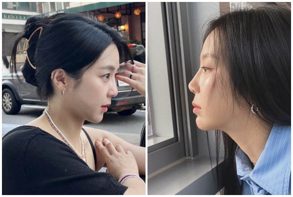 Jewelry Yewon, I said I wouldn't recognize your face...Why did you confess your nose job? 