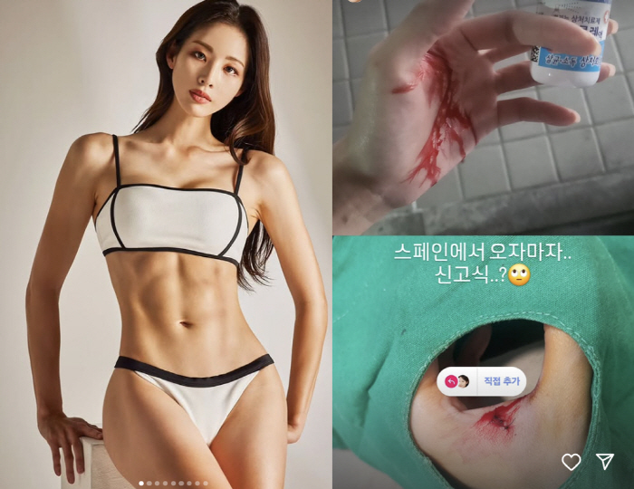 Shin Soo-ji reveals her bloody hands to the hospital after returning home → suture surgery