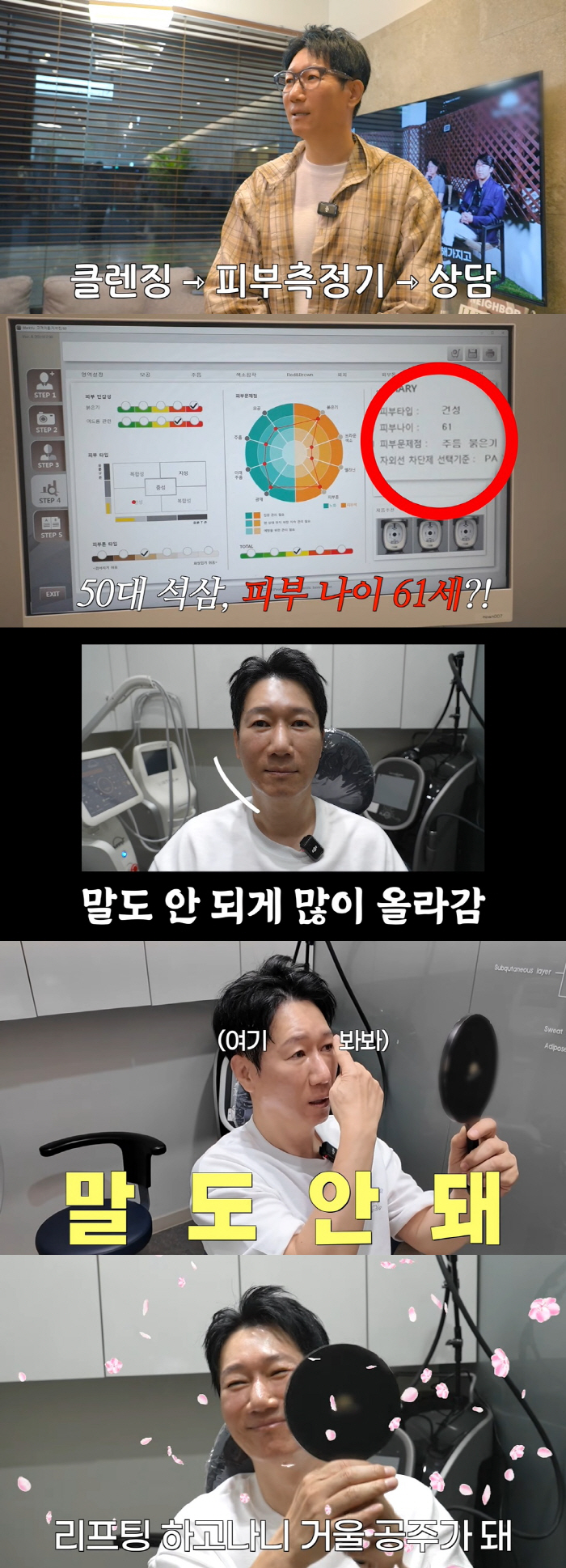 59-year-old Ji Seok-jin Has Changed Significantly After Lifting It goes up to the corners of your mouth