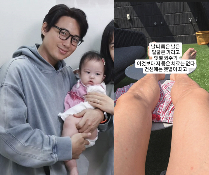 Lee Ji-hoon confessed to skin disease with his 9-month-old daughter, and the sun was the best for psoriasis in the rooftop