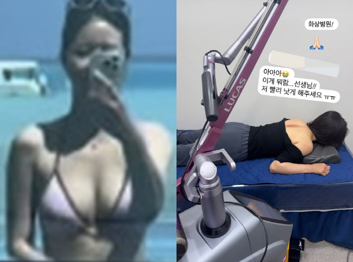 Park Hana, who is about to get married, has a serious burn wound..Get down on your bed and complain of pain 'I hope you get better soon.'