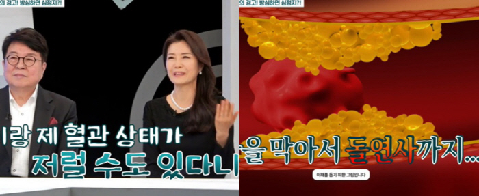 Song Ki-yoon ♥ Wife, health emergency vascular condition in her 70s is unusual (Perfect Life)