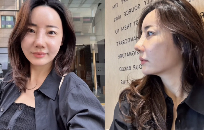 Cho Hye-ryeon, Park Hye-min, thank you for your unexpected beauty after the 3rd nose surgery