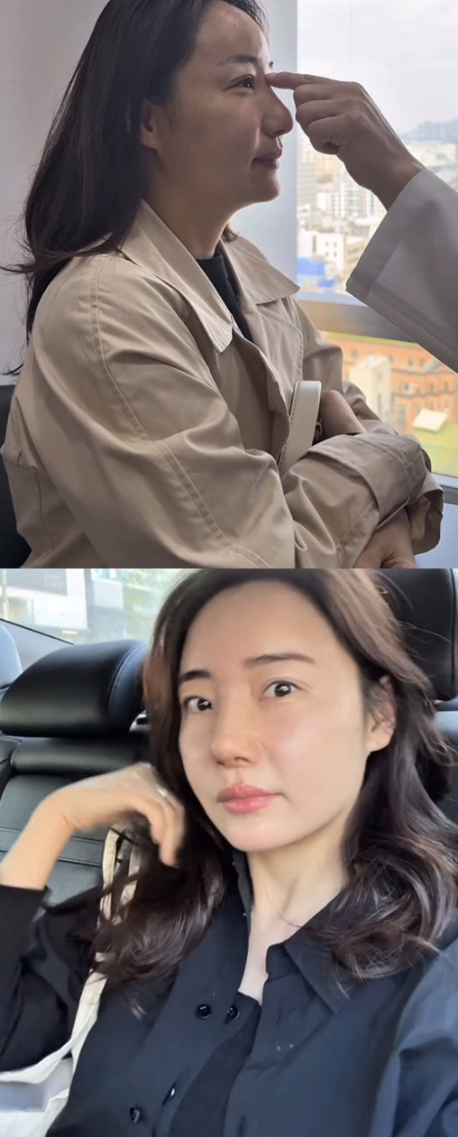 Cho Hye-ryeon, Park Hye-min, thank you for your unexpected beauty after the 3rd nose surgery